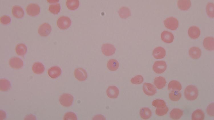Plasmodium falciparum parasites - first for our lab